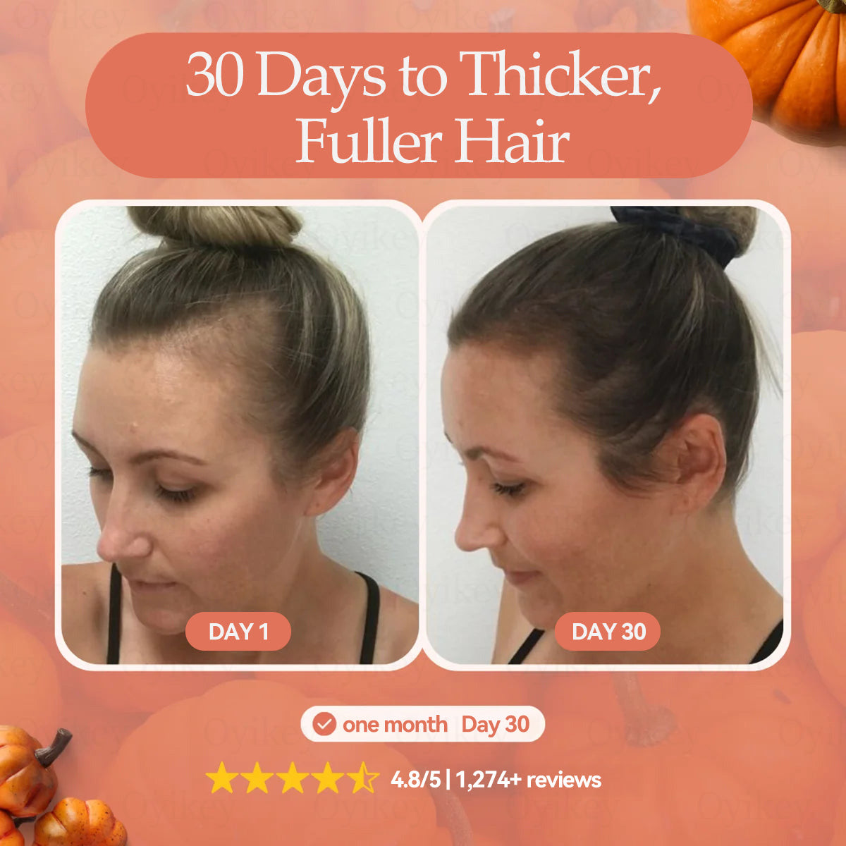 ๐ถ๐๐๐๐๐ฆยฎ ๐๐ข๐๐๐๐๐ ๐๐๐๐ ๐๐๐ ๐๐๐๐ก๐๐๐๐ ๏ผ๐ด๐๐๐๐๐ ๐  ๐กโ๐ โ๐๐๐ ๐๐๐๐๐๐๐ ๐๐ก ๐๐ก๐  ๐๐๐๐ก ๐๐๐ข๐ ๐๏ผ๐