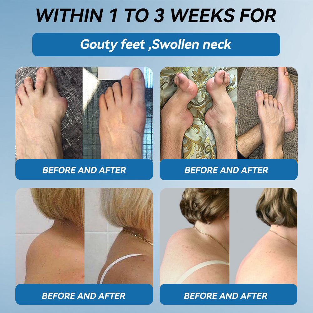 𝖯𝗂𝖼𝗱𝗼® BPC-157 Joint Healing Cream🦴Treats Arthritis, Neuropathy, Rheumatism, Sports Injuries & More👍