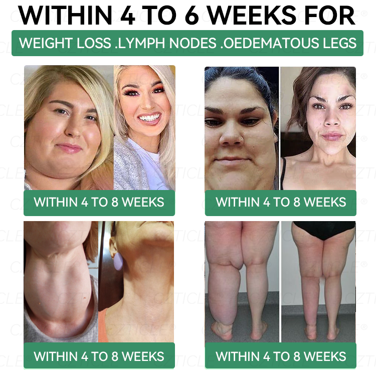 ⏳ Last Chance! Add more 𝐶𝑍𝑇𝐼𝐶𝐿𝐸® & Enjoy Extra 30% OFF! This Exclusive 30% OFF Deal is Reserved Just for You!