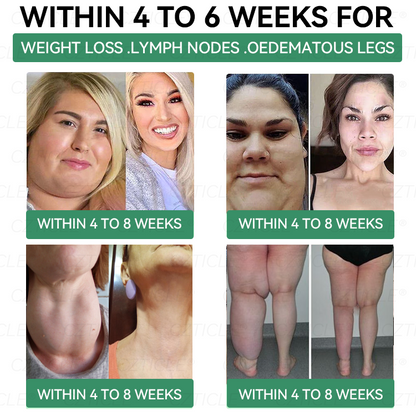 ⏳ Last Chance! Add more 𝐶𝑍𝑇𝐼𝐶𝐿𝐸® & Enjoy Extra 30% OFF! This Exclusive 30% OFF Deal is Reserved Just for You!