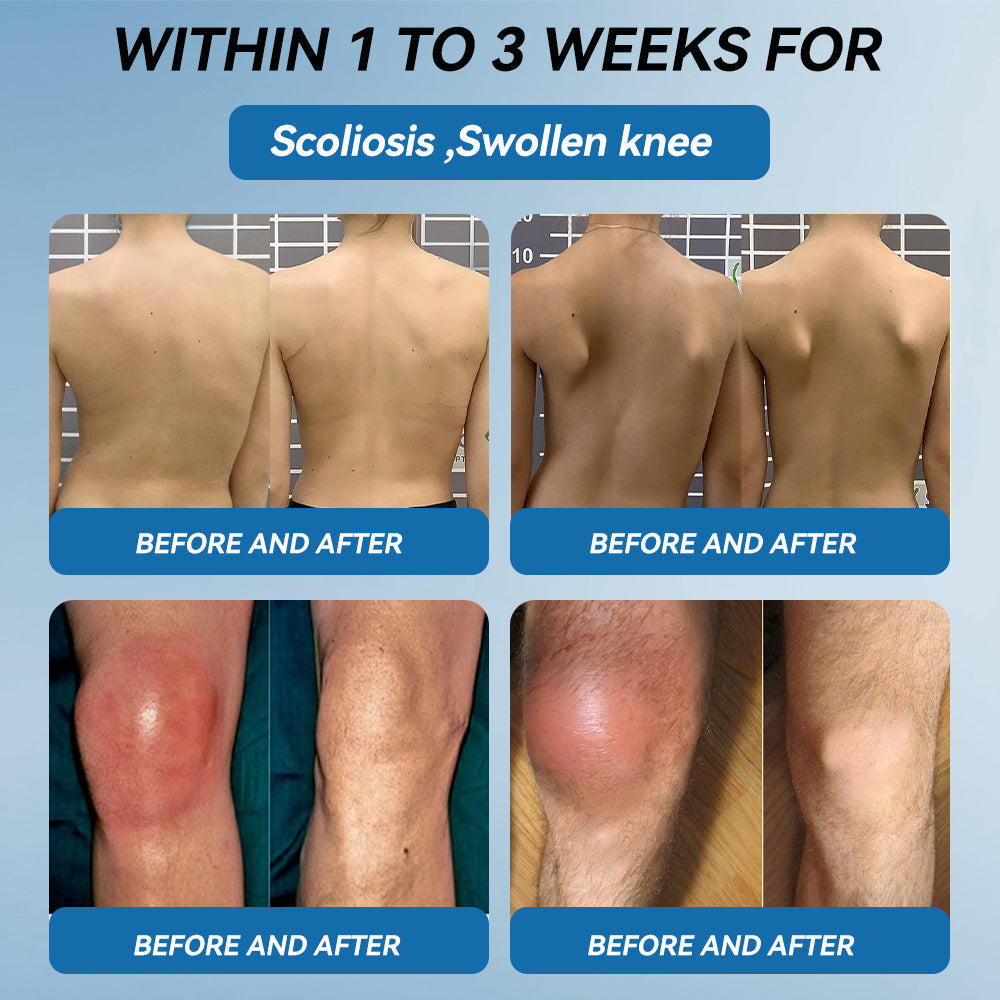 𝖯𝗂𝖼𝗱𝗼® BPC-157 Joint Healing Cream🦴Treats Arthritis, Neuropathy, Rheumatism, Sports Injuries & More🦵