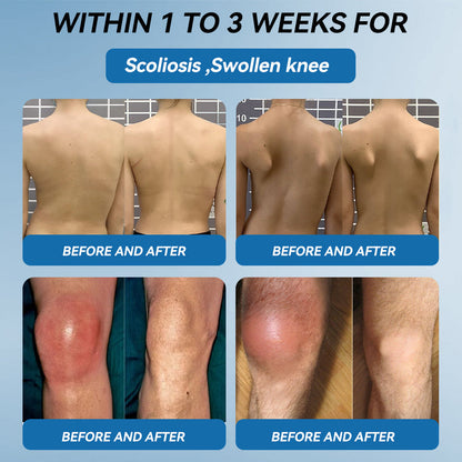 𝖯𝗂𝖼𝗱𝗼® BPC-157 Joint Healing Cream🦴Treats Arthritis, Neuropathy, Rheumatism, Sports Injuries & More🦵