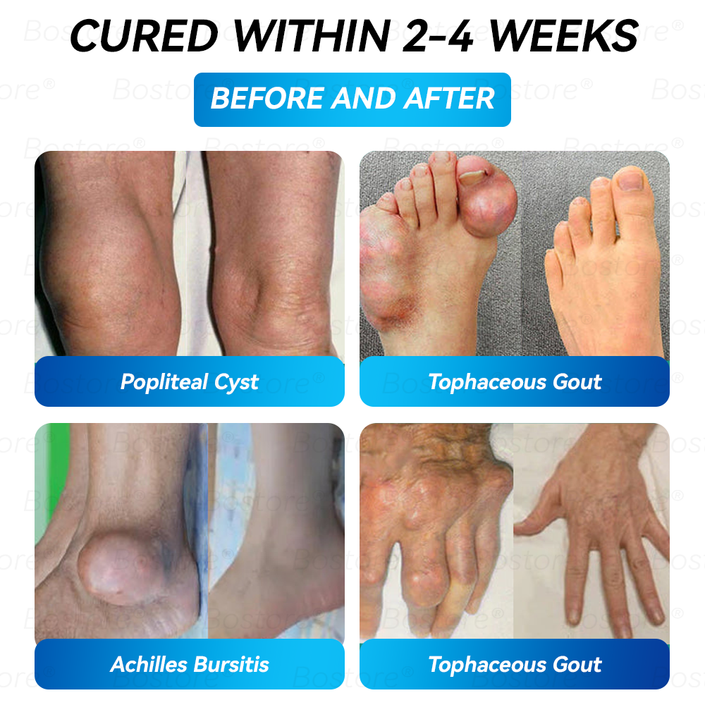 Bostore® BPC-157 Joint Restore Oral Liquid 🦴 Natural Peptide Support for Joints, Muscles, Recovery & Mobility